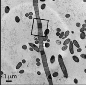 Strange behavior of bacteria with artificial proteins