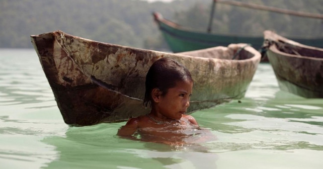 Strange children have 'dolphin eyes'