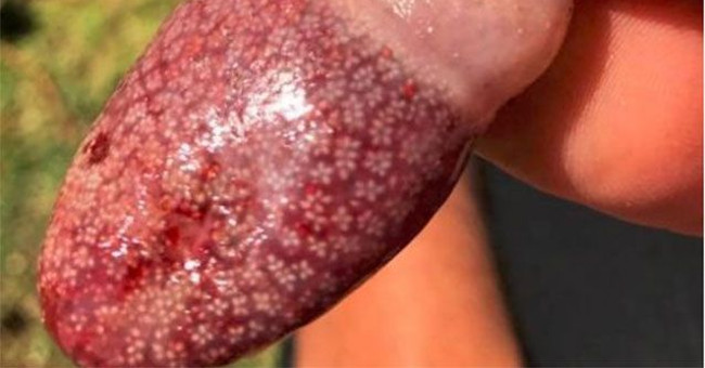 Strange creatures like human blades washed ashore on Australia