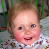 Strange disease: She was born without an immune system