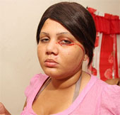 Strange girl crying and sweating blood