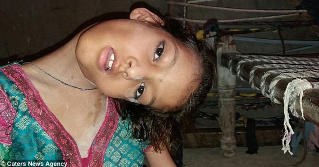 Strange illness caused the girl to bend over her neck