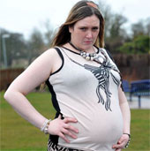 Strange illness makes a young woman like a pregnant woman for 15 years