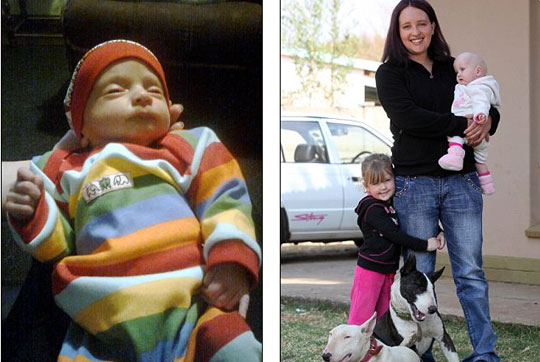 Strange illness turns a girl into a boy