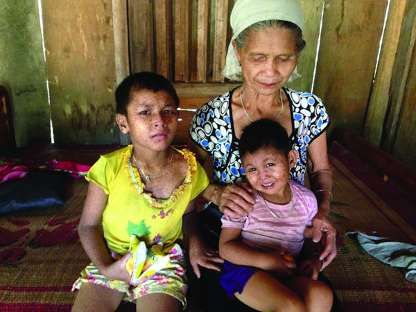Strange life-threatening disease of people in Phu Tho