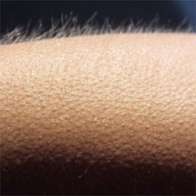 Strange reactions of the body with the cold