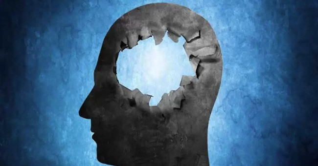 Strange stories are true about the human brain
