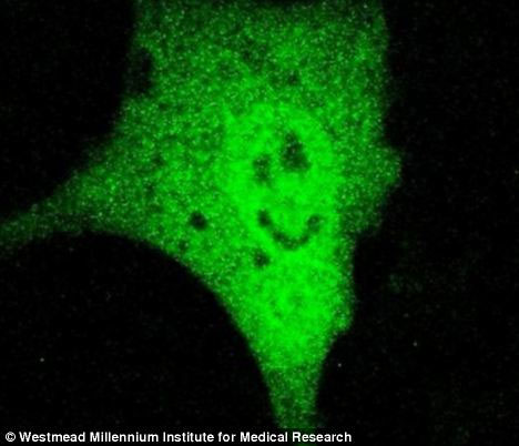 Strange story: Smiling face on the tumor