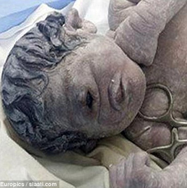 Strange story: The one-eyed boy was born in Egypt