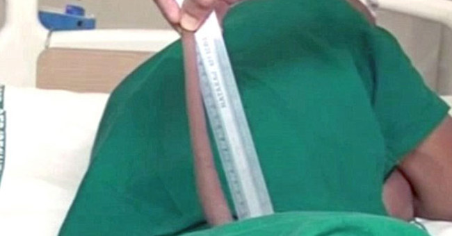 Strange story: The young male survives the tail about 18cm long