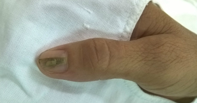 Striped nails watch out for the coil
