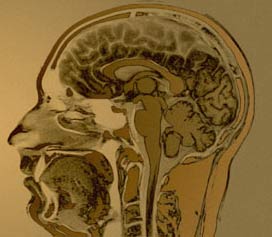 Strong brands are more likely to stick to the brain