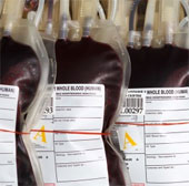 Study artificial blood test