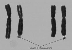 Study population by X chromosome