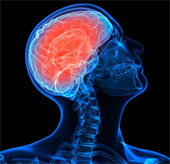 Stunned to find bacteria in the brain
