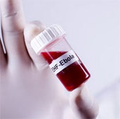 Successful development of antibodies that treat Ebola