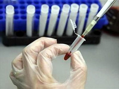 Successful preparation of vaccines against HIV