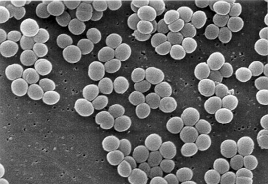 Successful research of harmless poisoning technology