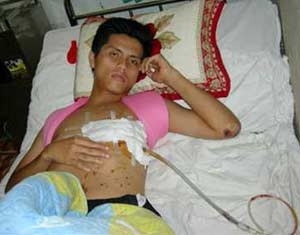 Successful surgery of heart failure