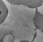 Successfully created kidney cells from stem cells