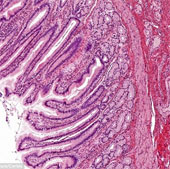 Successfully cultivate human intestinal tissue on mice