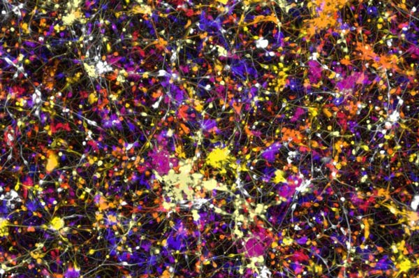 Successfully cultured neurons from fresh blood