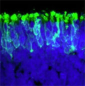 Successfully cultured retina from versatile stem cells