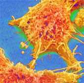 Successfully rearing the tumor separated the body