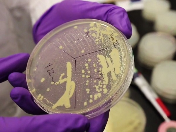 Successfully tested human gene implants on yeast