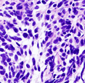 Successfully transformed stem cells into lung cells