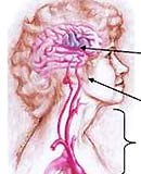 Sudden blurred vision may be a sign of cerebral anemia
