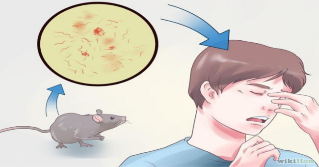 Suffering from sodoku because of a mouse bite