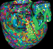 Super computer simulates human heart