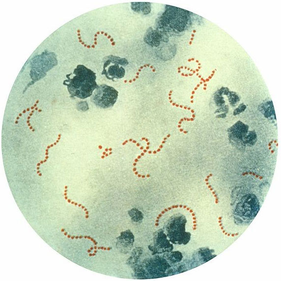 Super glue from meat-eating bacteria