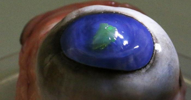 Super thin film can help the laser eye