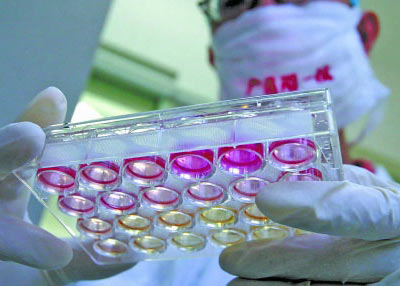 'Super virus' is spreading rapidly