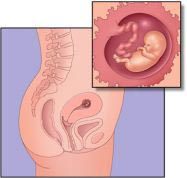 Surgery for an unborn baby