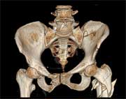 Surgical corpses without a scalpel