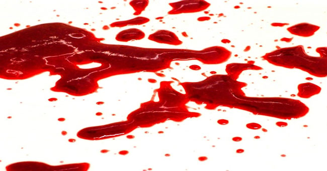 Surprise about the reason why many people see blood is fainting