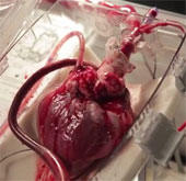 Surprised to see the human heart still beating outside the body while waiting for a transplant