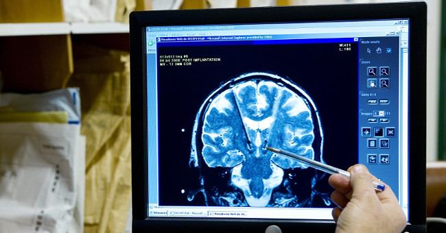 Surprised with special equipment that can translate thoughts into words