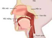 Symptoms of throat cancer