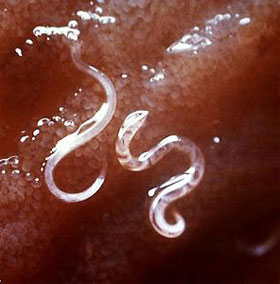 Take 2,500 eggs of parasitic worms to treat the disease