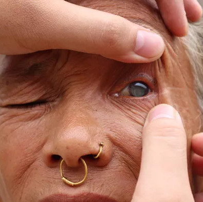 Talents help blind people see after ... 5 minutes