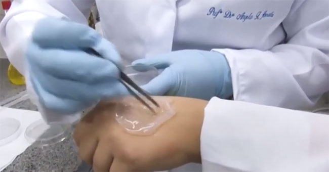 Tape made from pineapple helps wound healing