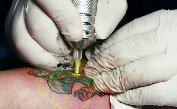 Tattoos look for skin infections