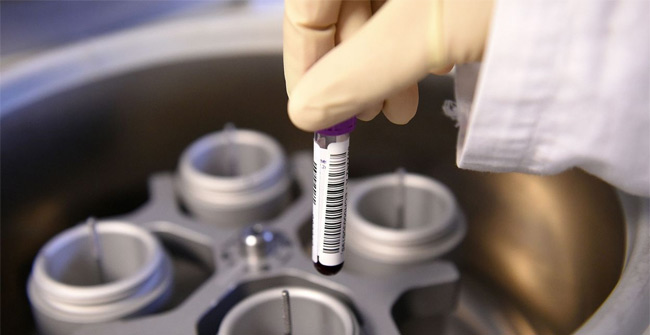 Technology can diagnose cancer