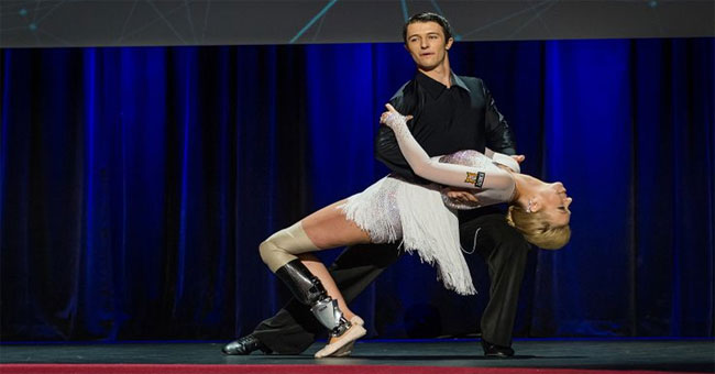 Technology helps people lose their legs dancing and swim like fish