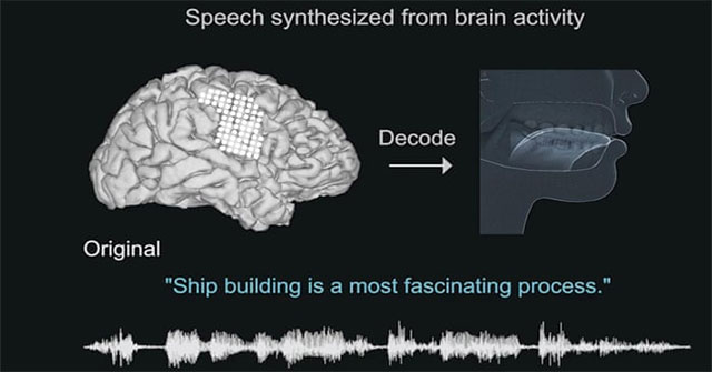 Technology turns brain signals into words, helping polio patients communicate