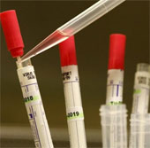 Test method for treating Ebola